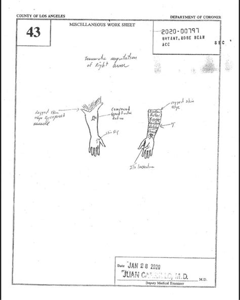 gigis autopsy report|Kobe Crash Autopsy Reports : r/CrimeScene